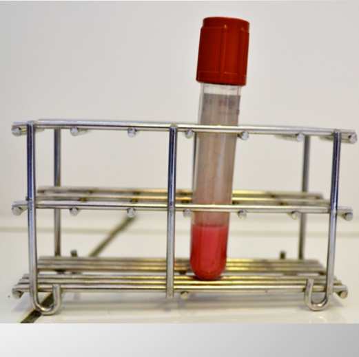 Tube endocrinologie Azurvet-Lab accueil